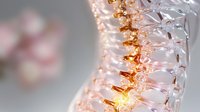 Anatomical spine model with glowing intervertebral discs showing inflammation and nerve compression, medical visualization on light background.
