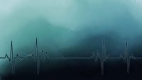 Medical heartbeat rhythm line on blue gradient background for healthcare and cardiology presentations.