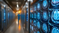 Brain MRI scans displayed on medical monitors in hospital corridor with blurred doctor silhouette and warm lighting creating dramatic healthcare atmosphere.