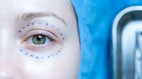 Young woman with blue dotted markings around eye for cosmetic surgery consultation and aesthetic treatment planning procedures.