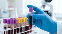 Medical laboratory technician in blue gloves holding blood sample test tube for analysis in clinical research facility with colorful specimen vials.