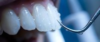 Close-up of white healthy teeth during dental examination with metal dental probe tool for oral health checkup and professional dental care.