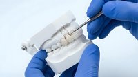 Dental technician in blue gloves placing ceramic crown on plaster jaw model with precision tool in prosthetics lab.