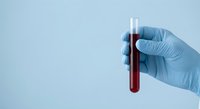 Medical professional in blue latex gloves holding test tube with blood sample for laboratory analysis and diagnostic testing in clinical setting.