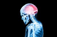 X-ray scan showing human skull and upper spine with highlighted red area indicating head trauma or pain, medical visualization on black background.