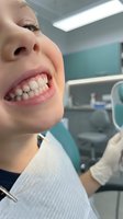 Young Caucasian woman patient smiling during dental examination in modern clinic office showing healthy white teeth for oral healthcare treatment.