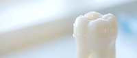 White ceramic dental crown on soft blurred background for oral health and dentistry concepts in medical and healthcare applications.