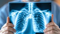 Medical professional holding chest x-ray showing detailed view of human ribcage, lungs and spine in bright blue tones against illuminated background for healthcare concept.