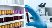 Medical laboratory technician in blue gloves holding blood sample tube for testing and analysis in modern clinical research facility with microscope.