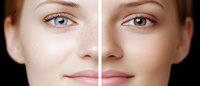 Split face comparison showing skin tone and eye color differences, highlighting facial features and beauty contrasts against black background. Natural makeup look.
