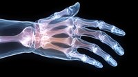 X-ray scan of human hand showing detailed bone structure with blue and pink coloring highlighting joints and skeletal anatomy against dark background.