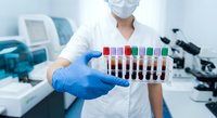 Medical laboratory technician in white coat and blue gloves holding test tubes with blood samples for analysis in modern clinical laboratory setting.