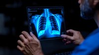 Medical professional examining digital chest x-ray scan on tablet device showing detailed view of lungs and ribcage in glowing blue diagnostic display.