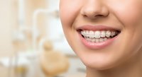 Young woman with metal braces smiling showing straight white teeth in modern dental office. Orthodontic treatment and oral health care concept.