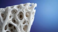 White porous bone structure with circular holes on blue gradient background showing osteoporosis medical condition for healthcare education materials.