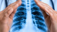 Medical professional examining chest x-ray scan showing lungs and ribcage in blue tones, hands visible at edges for healthcare and radiological concepts.