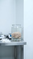 Human brain specimen preserved in glass jar on laboratory table with medical equipment for scientific research and anatomical study.
