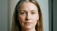 Young woman face showing aging process with wrinkles and smooth skin comparison for skincare and beauty treatment concepts.