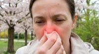Young Caucasian woman blowing nose with tissue during spring allergy season outdoors with blooming cherry trees in background. Seasonal pollen allergies concept.