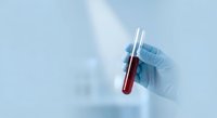 Medical professional in blue latex gloves holding test tube with blood sample for laboratory analysis and diagnostic testing in clinical environment.