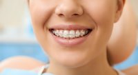 Young woman with metal braces smiling showing orthodontic treatment for dental care and teeth straightening in modern clinic setting.