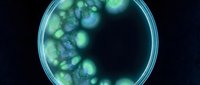 Green bacterial colonies growing in laboratory petri dish for microbiology research and scientific analysis of microorganisms in controlled environment.