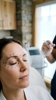 Middle-aged Caucasian woman receiving cosmetic injection treatment with blue marking dots on face in modern medical clinic for anti-aging procedure.