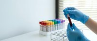 Laboratory technician in blue gloves holding blood sample test tube with colorful specimen rack in modern medical research facility for diagnostic testing.