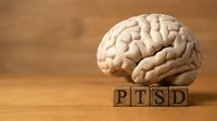 Brain model beside wooden blocks spelling PTSD on a wooden surface, symbolizing post-traumatic stress disorder awareness and mental health.