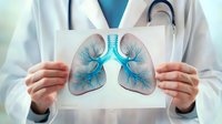 Medical professional holding anatomical illustration of human lungs with blue bronchi pattern against white coat background, healthcare concept for respiratory system.