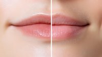Close up view of female lips showing cosmetic treatment comparison with vertical line dividing enhanced and natural sides for beauty industry marketing.