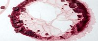 Histological cross-section of lymph node tissue showing follicular architecture with germinal centers and surrounding lymphocytes, used for pathology education and medical research.