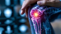 Glowing red anatomical knee joint visualization with digital overlay showing inflammation and pain points in medical diagnostic display. Doctor pointing.