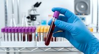 Medical laboratory technician in blue gloves holding blood sample tube for testing and analysis in clinical research facility with microscope equipment.
