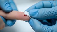 Medical professional in blue gloves performing finger prick blood test with lancet device for glucose monitoring or diagnostic sampling in clinical setting.