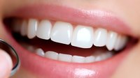 Close up of healthy white teeth and pink lips showing genuine smile with dental mirror reflection, representing dental care and oral hygiene concept.