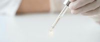 Medical professional in white gloves using glass pipette for precise liquid sample analysis in sterile laboratory environment for scientific research.