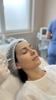 Woman receiving cosmetic injection treatment with marked face lying on medical table in clinic with healthcare professional in background.