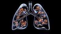 Anatomical visualization of human lungs with glowing orange bronchial tree branches against dark background, medical science illustration showing respiratory system.