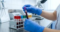 Laboratory technician in blue gloves holding test tube with yellow liquid sample in modern medical research facility for scientific analysis.