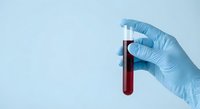 Medical professional hand in blue latex glove holding blood sample test tube for laboratory analysis and diagnostic testing procedures.