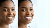 Young African American woman showing teeth whitening transformation with bright smile before and after dental treatment for oral care and cosmetic dentistry.