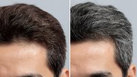 Close-up comparison of male hair before and after graying, showing natural aging process with dark brown hair transforming to salt and pepper gray.