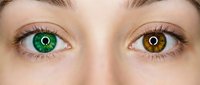 Close-up portrait of young woman with heterochromia showing one green eye and one brown eye, genetic condition creating unique facial feature.