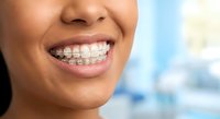 Young woman with metal braces smiling showing orthodontic treatment in dental office for teeth straightening and oral health care.