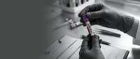 Hands in black gloves holding a labeled blood test tube in a lab, monochrome tone with selective color for medical and healthcare use.