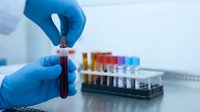 Medical laboratory technician in blue gloves holding blood sample test tube with colorful specimens in background for clinical analysis and diagnosis.