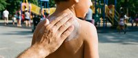 Man applying sunscreen lotion on shoulder at outdoor playground, sun protection and skin care for summer activities and beach safety.