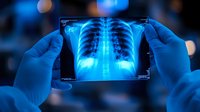 Medical professional in blue gloves examining chest x-ray film showing ribcage and spine against glowing blue background with bokeh lights, healthcare concept.