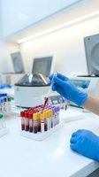 Laboratory technician in blue gloves handling blood sample tubes with pipette in modern medical research facility for diagnostic testing and analysis.